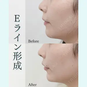 L‘amour clinic Tokyo【ラムールクリニック東京】の症例