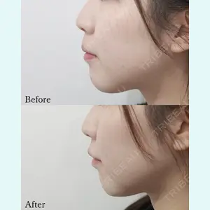 L‘amour clinic Tokyo【ラムールクリニック東京】の症例