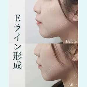 L‘amour clinic Tokyo【ラムールクリニック東京】の症例