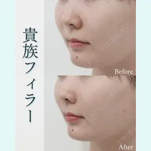 L‘amour clinic Tokyo【ラムールクリニック東京】の症例
