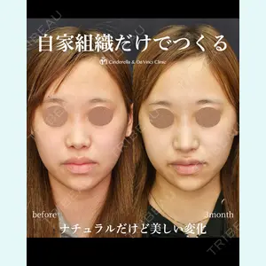 シンデレラ＆ダヴィンチクリニック 宮田 洋佑医師の症例