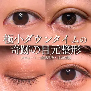 症例