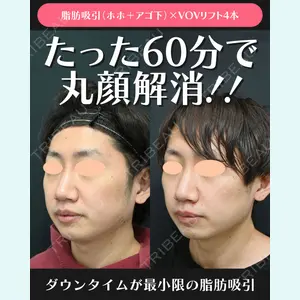 湘南美容クリニック 川崎院 伊藤 賀敏医師の症例