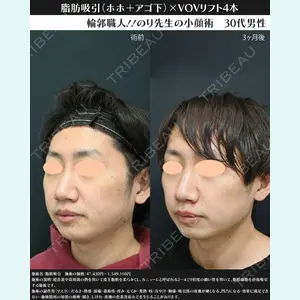 湘南美容クリニック 川崎院 伊藤 賀敏医師の症例