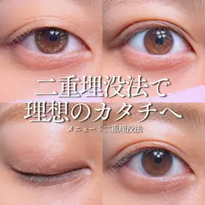 症例