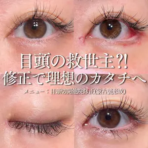 症例