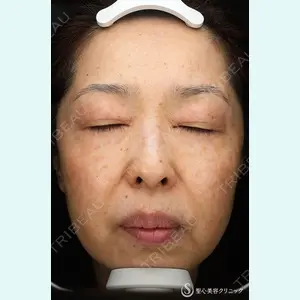 聖心美容クリニック 熱海院 小林 美幸（皮膚科）医師の症例