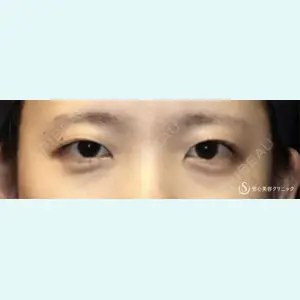 聖心美容クリニック 六本木院 綾部 奈々子医師の症例