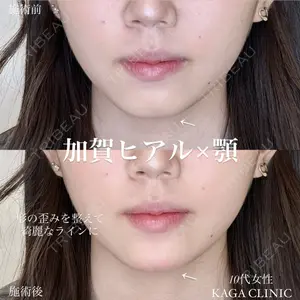 症例