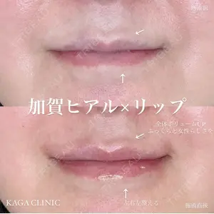 症例