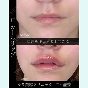 症例