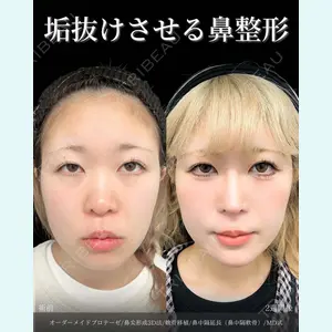 症例