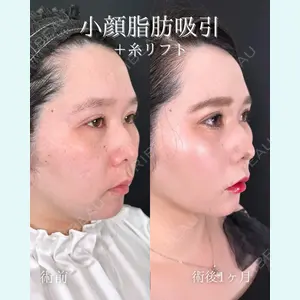 症例