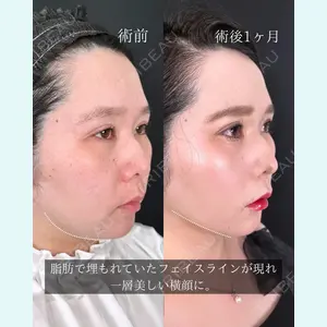 東京シンデレラ美容外科 池袋院 石井 達也医師の症例