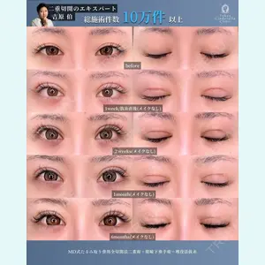 症例