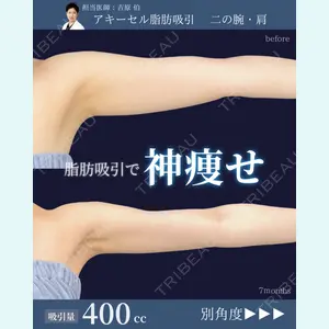 症例