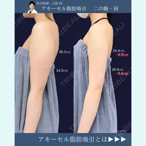 症例