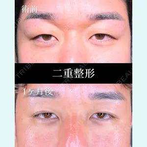HAAB×DREAM BEAUTY CLINIC 大阪梅田院 柏木 太雅医師の症例
