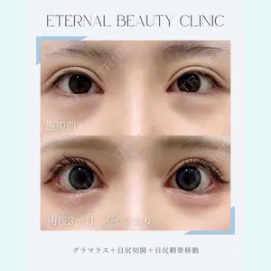 エターナル美容クリニック 久門田 詳医師の症例