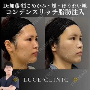 ルーチェクリニック 銀座院 加藤晴之輔医師の症例