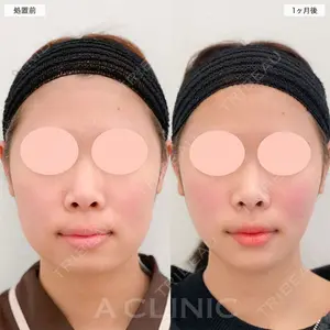 症例