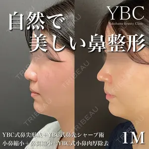 YBC横浜美容外科 大宮院 磯村 亮輔医師の症例
