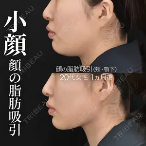 ジョウクリニック 銀座院 佐藤 光医師の症例