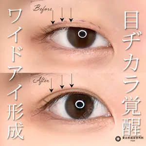 症例