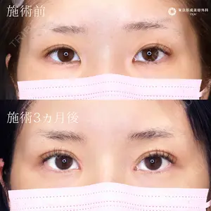 東京形成美容外科 船橋院 弓削田　浩主医師の症例
