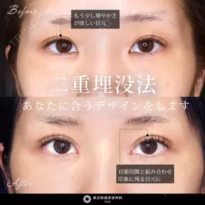 症例