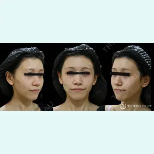 聖心美容クリニック 熱海院 小林 美幸（皮膚科）医師の症例