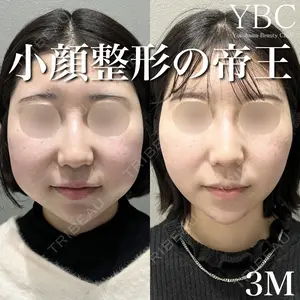 YBC横浜美容外科 大宮院 磯村 亮輔医師の症例
