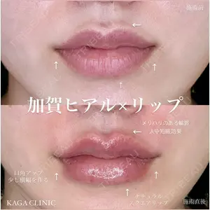 症例