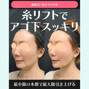 湘南美容クリニック 川崎院 伊藤 賀敏医師の症例