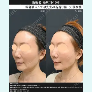 湘南美容クリニック 川崎院 伊藤 賀敏医師の症例