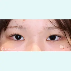 聖心美容クリニック 六本木院 川端 優也医師の症例