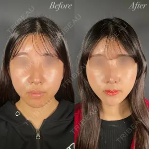R Beauty CLINIC 大阪院 小池 泰弘医師の症例