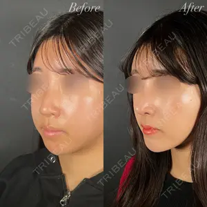 R Beauty CLINIC 大阪院 小池 泰弘医師の症例