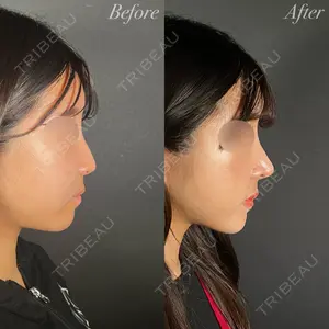 R Beauty CLINIC 大阪院 小池 泰弘医師の症例
