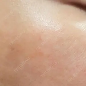 やさしい美容皮膚科・皮フ科　秋葉原院の症例