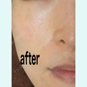 やさしい美容皮膚科・皮フ科　秋葉原院の症例