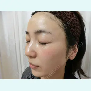 やさしい美容皮膚科・皮フ科　秋葉原院の症例