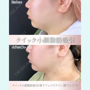 ルラ美容クリニック 大阪本院 平田 一記医師の症例