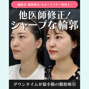 湘南美容クリニック 川崎院 伊藤 賀敏医師の症例