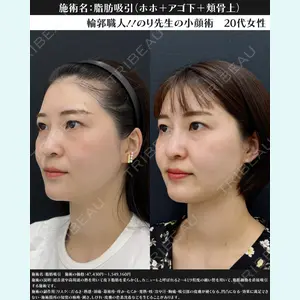 湘南美容クリニック 川崎院 伊藤 賀敏医師の症例