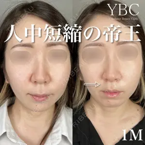 YBC横浜美容外科 大宮院 磯村 亮輔医師の症例