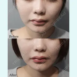 L‘amour clinic Tokyo【ラムールクリニック東京】の症例