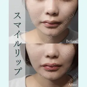 L‘amour clinic Tokyo【ラムールクリニック東京】の症例