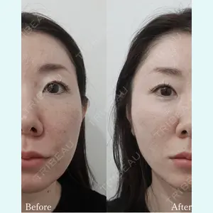 L‘amour clinic Tokyo【ラムールクリニック東京】の症例
