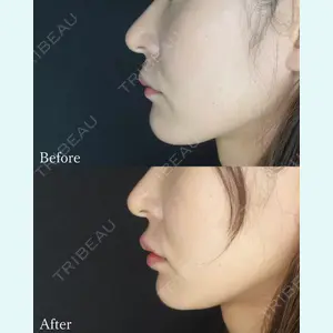 L‘amour clinic Tokyo【ラムールクリニック東京】の症例